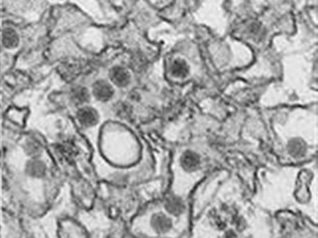 US officials advise doctors about tests for Zika
