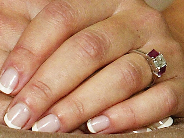 Man needed surgery after swallowing stolen ring