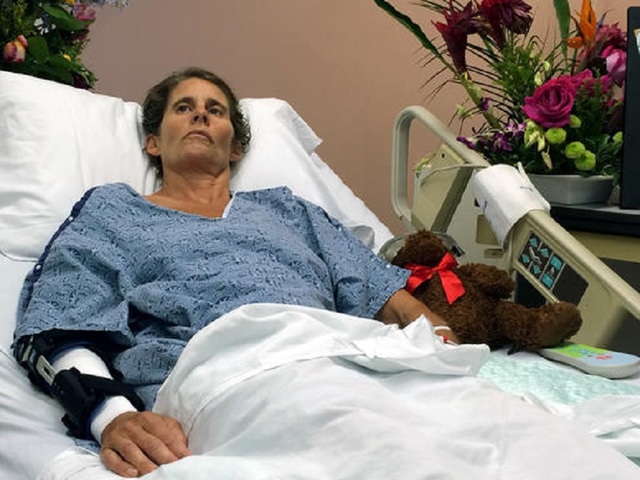 Woman recalls shark bite, rescue