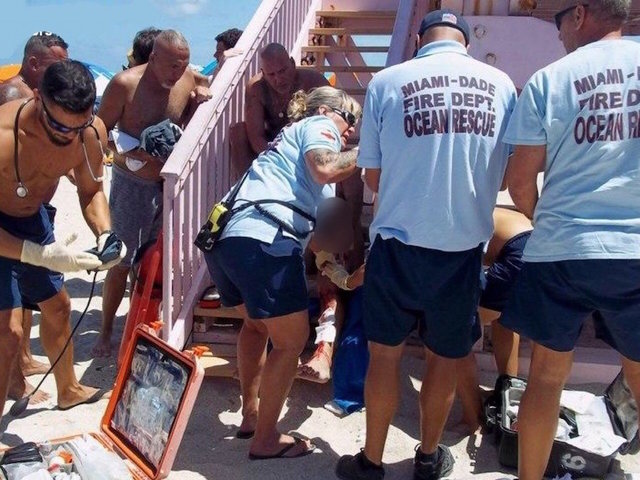 Miami Beach area swimmer attacked by shark
