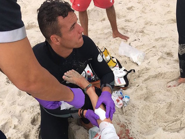 2 children bitten in suspected shark attacks off New York coast